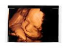 Ultrasound examination of the uterus and ovaries: norms, methods, timing